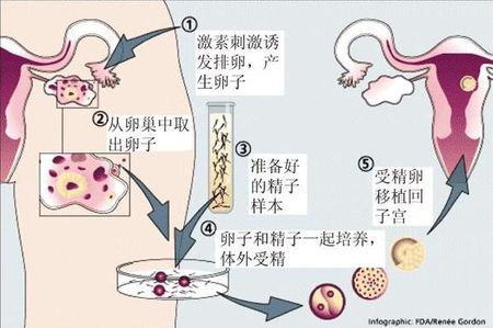 供卵联系方式